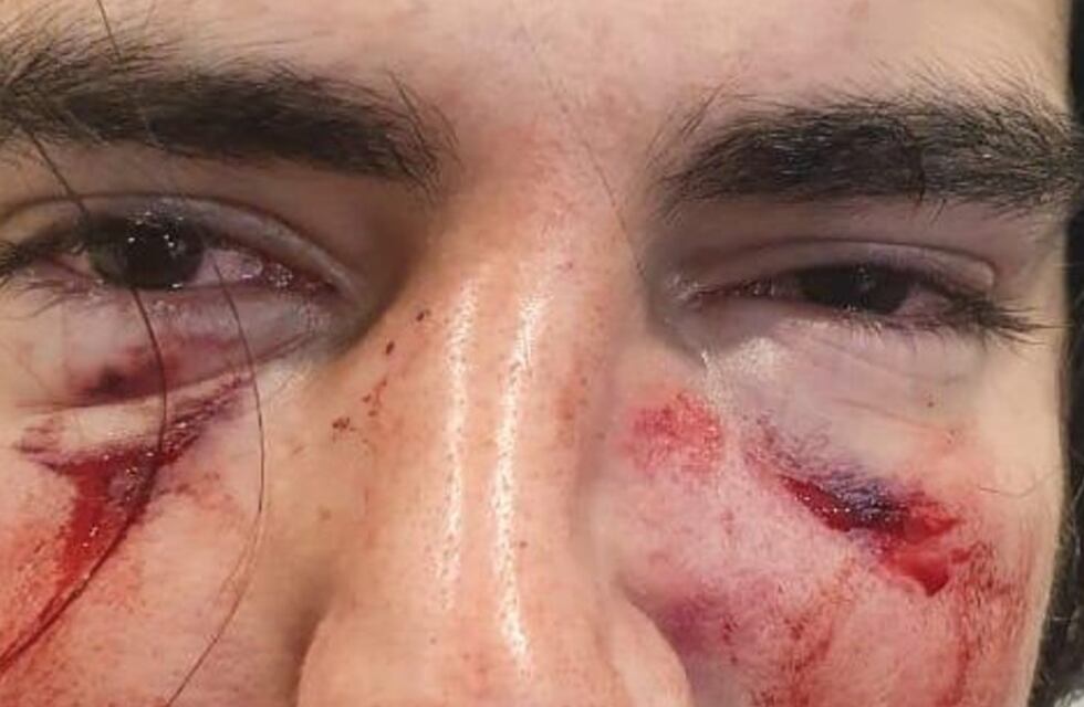 Se complica la situación de los rugbiers que golpearon a un joven y piden que los detengan