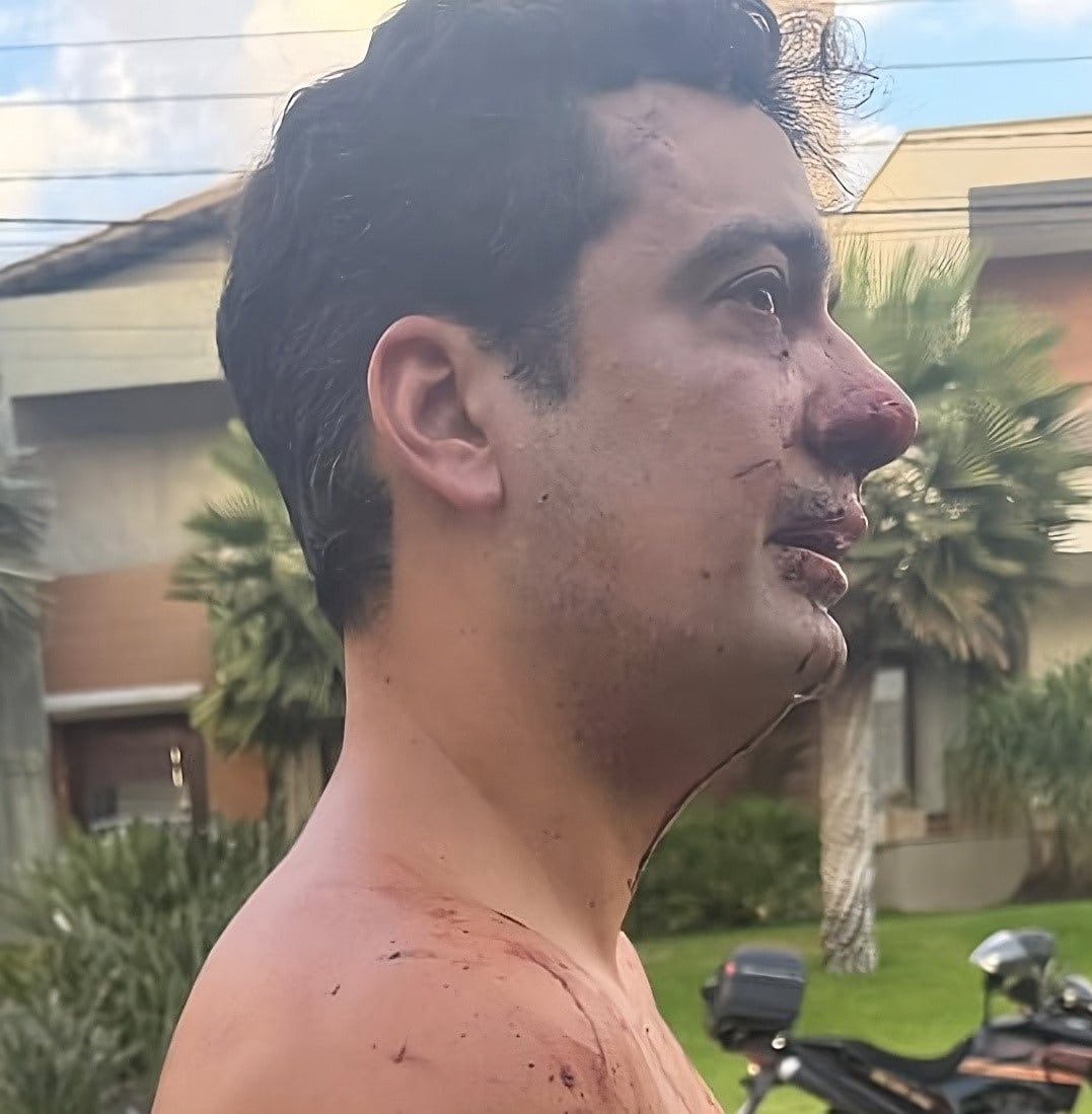 El vecino que acusó a Mancuso de morderlo