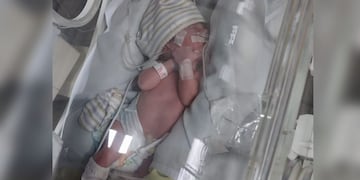 El pequeño sanjuanino de 27 días que lucha por su vida y necesita un medicamento que no se consigue en el país.