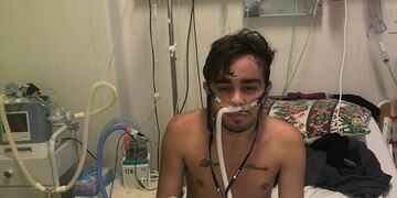 El joven de 21 años fue diagnosticado con fibrosis quística a los pocos meses de nacer y con el paso del tiempo su cuadro se volvió cada vez más complejo.