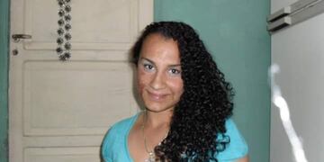 La joven de Godoy Cruz que sufrió quemaduras en su cuerpo y cara.