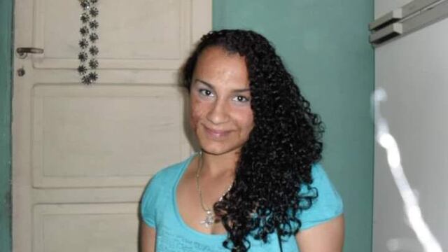 La joven de Godoy Cruz que sufrió quemaduras en su cuerpo y cara.