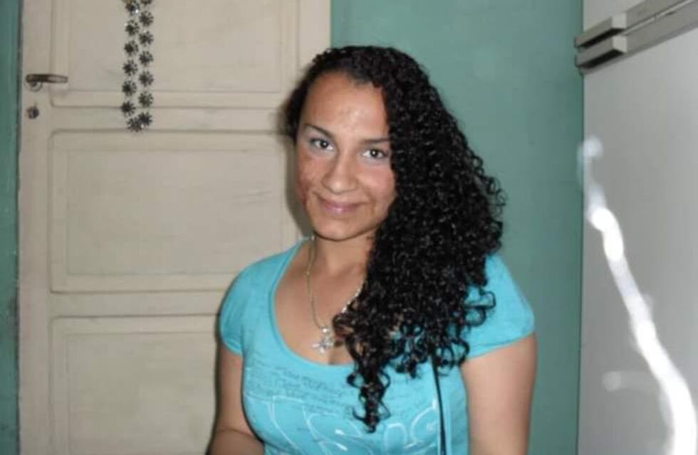 De niña sufrió quemaduras en un incendio y las marcas en su rostro aún la acompañan