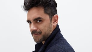 Gonzalo Heredia se sometió a un tratamiento estético por su hija Alfonsina: el tierno video que se hizo viral