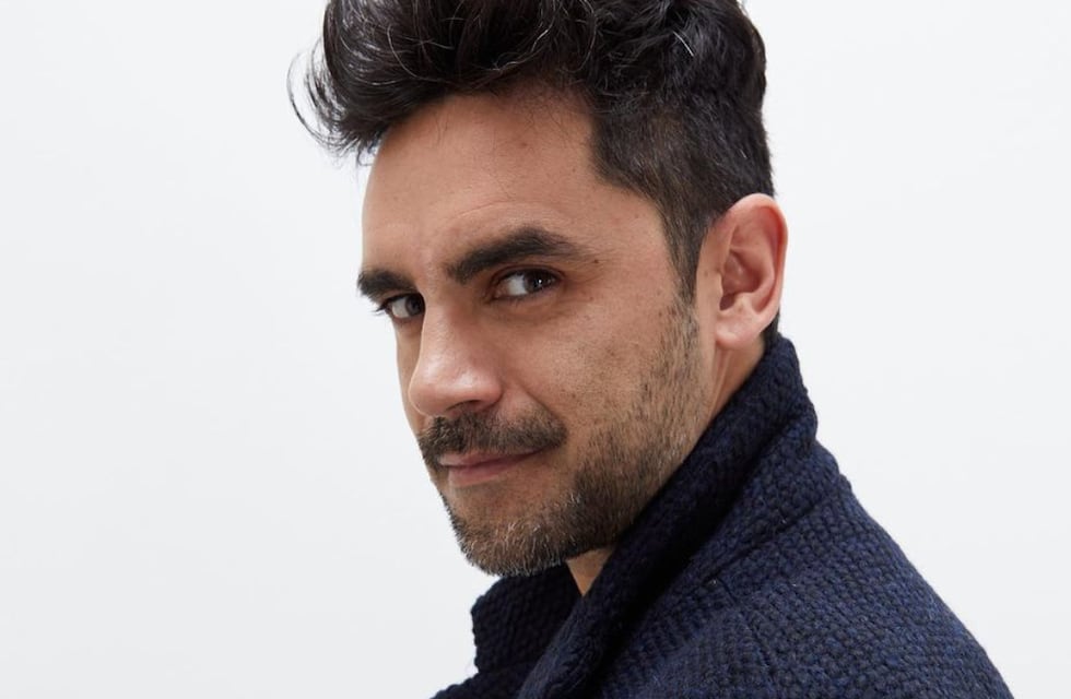 Gonzalo Heredia se sometió a un tratamiento estético por su hija Alfonsina: el tierno video que se hizo viral