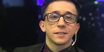 El antes y después de Rodrigo Noya: así fue su cambio físico tras la cirugía