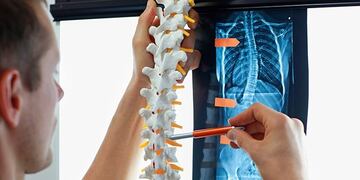 Escoliosis Hepática del Adolescente