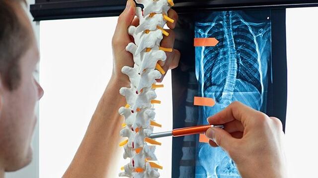 Escoliosis Hepática del Adolescente