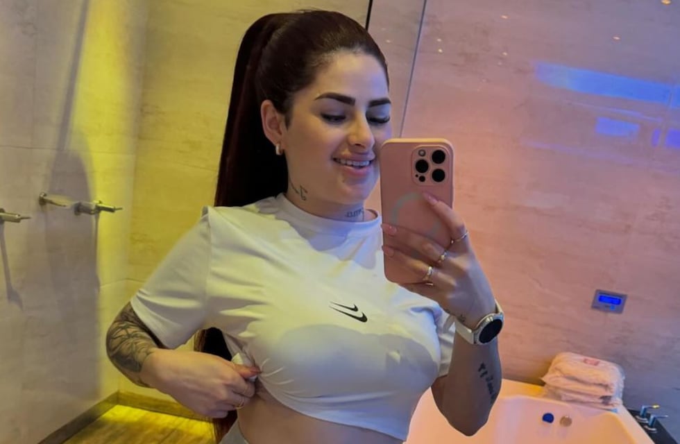 Radical: Kami Franco mostró los resultados de la nueva cirugía estética a la que se sometió