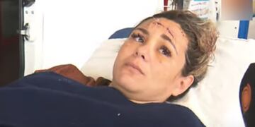 Gisel Vaca, la mujer baleada en barrio Cooperativa Güemes (Captura de video).