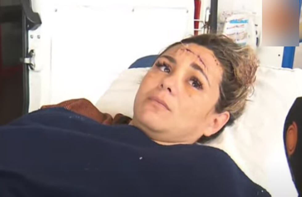 El nuevo parte de la mujer baleada por motochorros en Córdoba: cuándo le podrían dar el alta