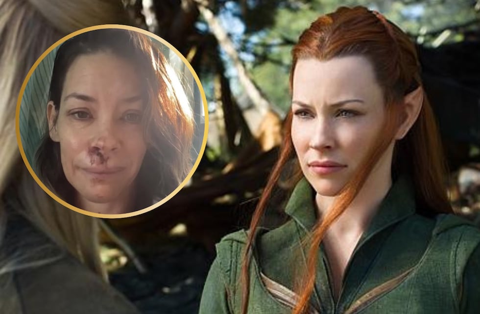 Preocupación por la actriz Evangeline Lilly: el accidente que le causó daño cerebral y la alejó de la actuación