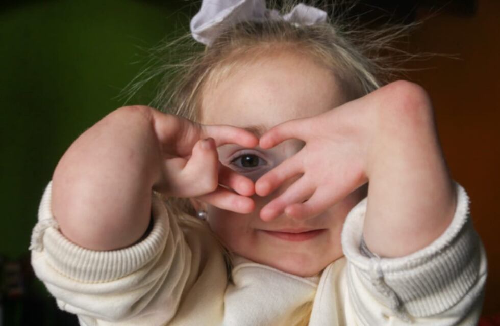 Juanita, la pequeña mendocina consiguió los pasajes para ser operada, pero aún deben recaudar dinero