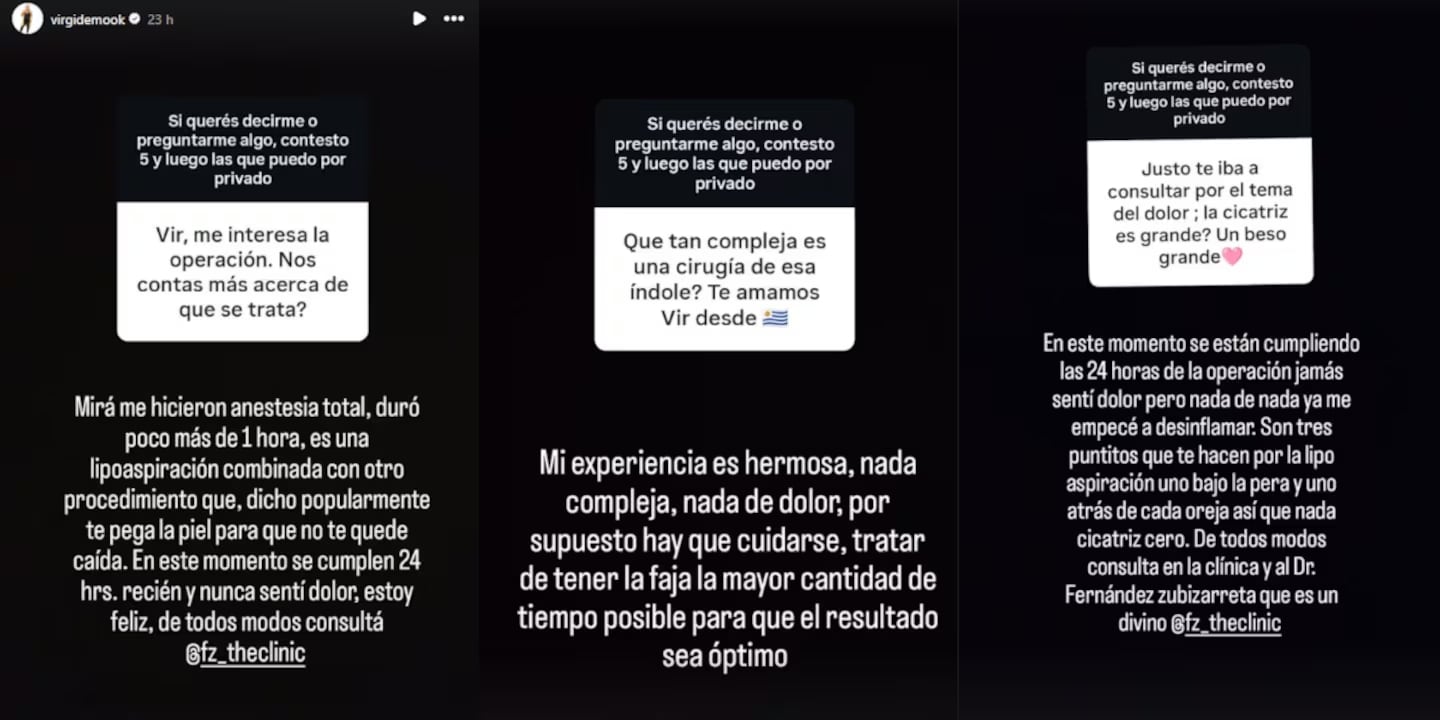 La cirugía estética de Virginia Demo de Gran Hermano: el impresionante cambio