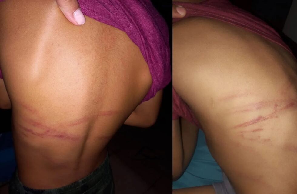 Preocupación en Posadas por Enzo, un niño de siete años que es golpeado por su mamá