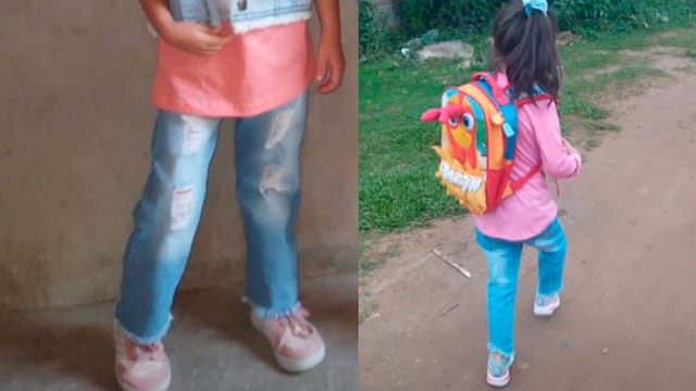 Le operaron por error una pierna.