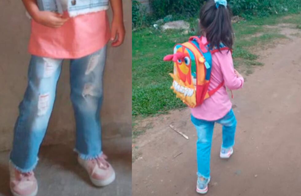 Denuncian por mala praxis a médicos de Concordia por operarle por error una pierna a una niña de 5 años