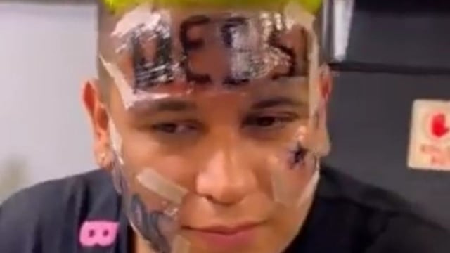 El peor tatuaje de la historia, sobre Argentina Campeón.