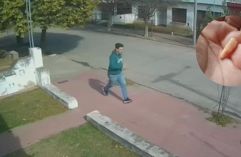 Habló el menor con Asperger que perdió dos dientes por un brutal robo en Córdoba