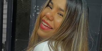 El impresionante antes y después de Camilota de Cuestión de Peso tras someterse a un tratamiento estético