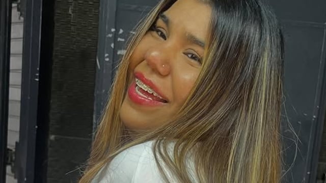 El impresionante antes y después de Camilota de Cuestión de Peso tras someterse a un tratamiento estético