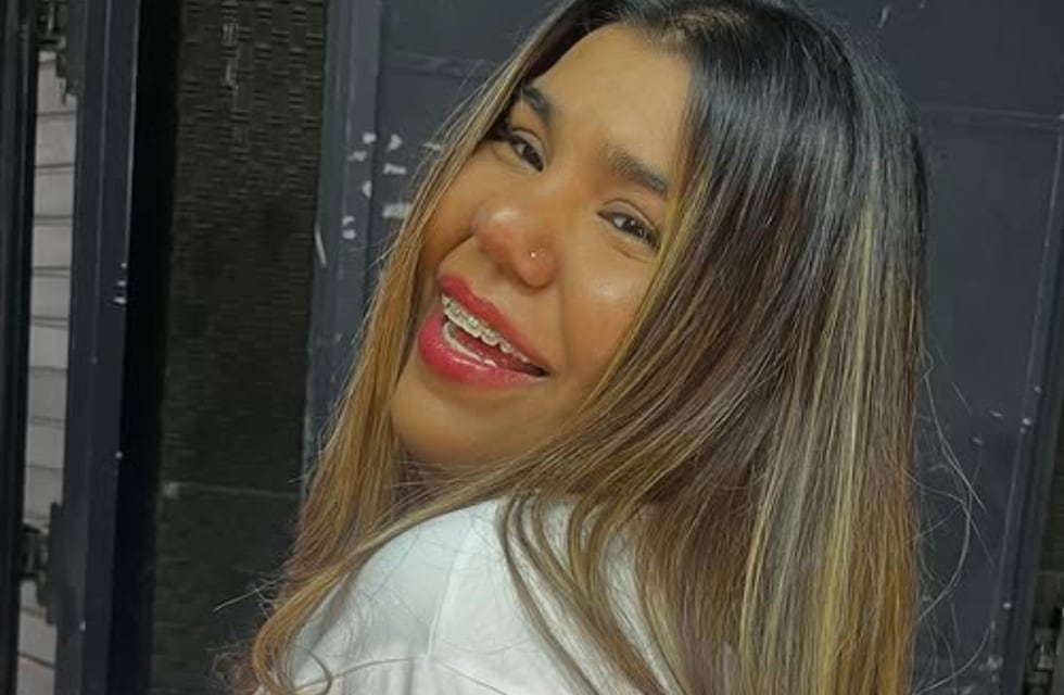 El impresionante antes y después de Camilota de Cuestión de Peso tras someterse a un tratamiento estético