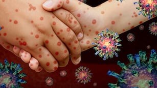 Ómicron y el Sarampión. (Shutterstock / Lightspring)