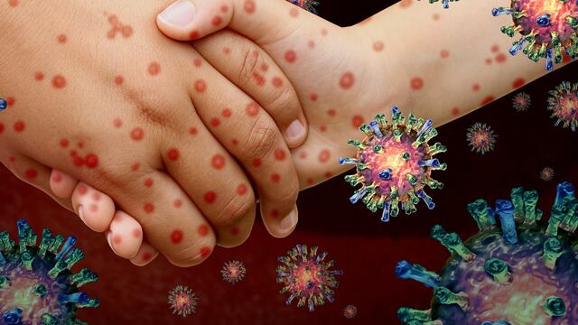 Ómicron y el Sarampión. (Shutterstock / Lightspring)