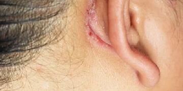 Una joven de 16 años fue atacada por su pareja tras negarse a conseguir dinero para comprarle drogas.