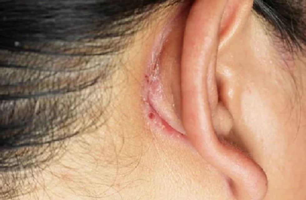 Se negó a salir a conseguir dinero para comprar droga y su pareja la atacó a ladrillazos