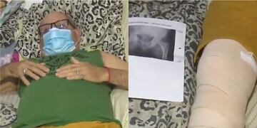 El hombre aseguró que caminaba con bastón por el dolor en la cadera, pero le reemplazaron la rodilla. (Captura de pantalla El Show del Lagarto)