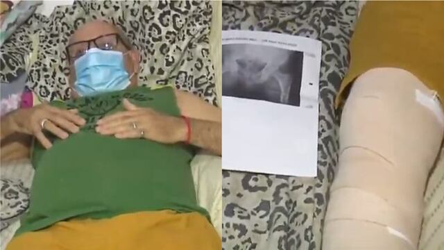 El hombre aseguró que caminaba con bastón por el dolor en la cadera, pero le reemplazaron la rodilla. (Captura de pantalla El Show del Lagarto)