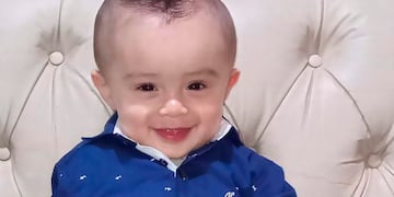 Enzo Julián Sánchez nació con una anomalía en el cráneo y necesita un casco especial. Foto gentileza.