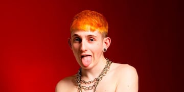 El antes y después de Dillom.