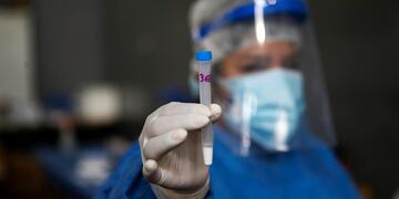 Una prueba de coronavirus.