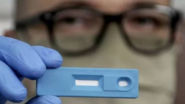 El objetivo del test es conocer cómo afecta el virus a animales de compañía y de producción, pensando en el concepto de "Una salud". (Cronista)