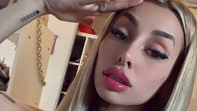 Tamara Báez se someterá a un nuevo procedimiento estético.