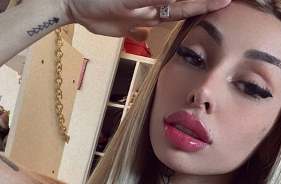 Tamara Báez se hizo una cirugía, mostró cómo le quedó la cara y preocupó a sus seguidores de Instagram