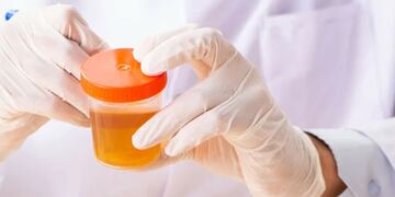 Análisis de orina.