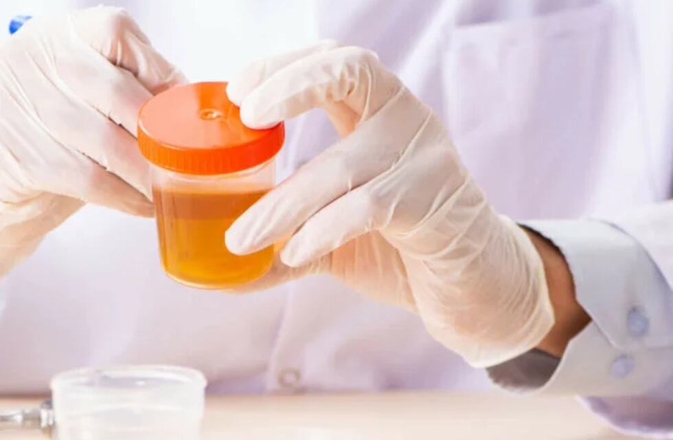 Insólito: un cordobés llegó antes de que abra el laboratorio y dejó su frasco de orina en un particular lugar