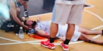 El puntaltense Claudio Ramírez fue agredido en un partido de básquet amateur.