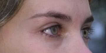 La joven tiene un problema en su ojo derecho y puede perder la vista.