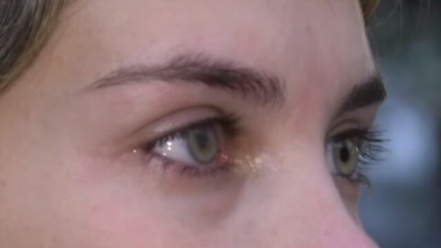 La joven tiene un problema en su ojo derecho y puede perder la vista.