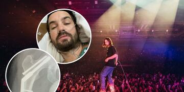 Kevin Parker de Tame Impala se fracturó la cadera a días de su presentación en el Lollapalooza Argentina 2023