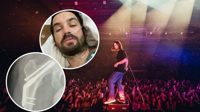 Kevin Parker de Tame Impala se fracturó la cadera a días de su presentación en el Lollapalooza Argentina 2023