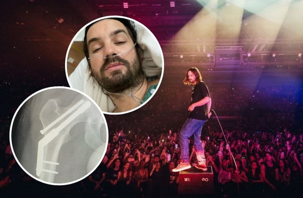 Kevin Parker de Tame Impala se fracturó la cadera a días de su presentación en el Lollapalooza Argentina 2023