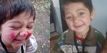 Córdoba. Emir, el niño que podrá ser operado.