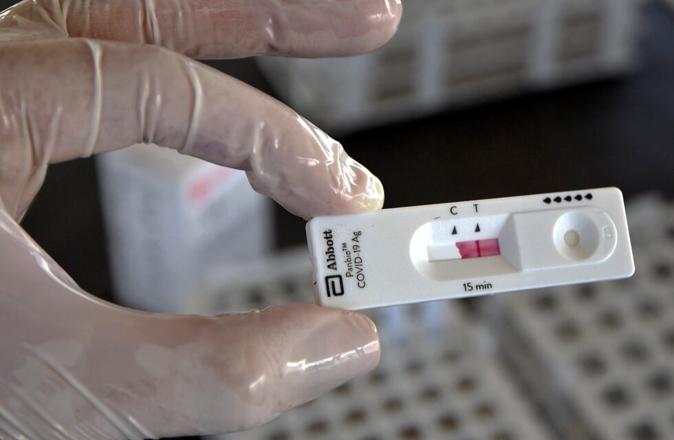 Estados Unidos dejará de pedir test negativo de Covid a los argentinos para ingresar al país