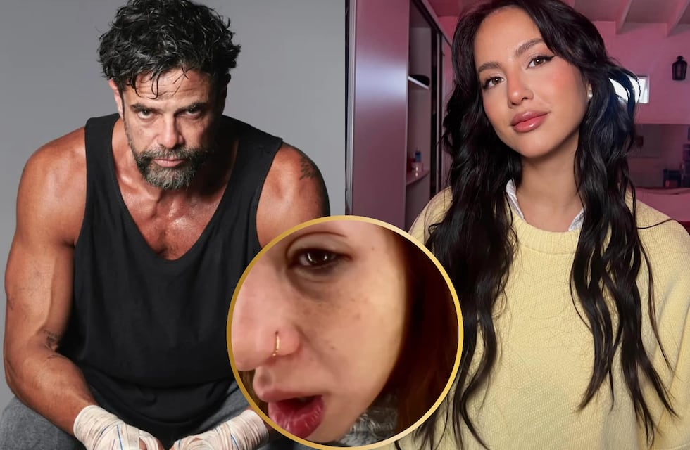 El impactante video de Flor Vigna con la cara desfigurada luego de su separación: “No me animaba a...”