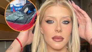 Camila Lattanzio, la ex Gran Hermano, reapareció tras su grave accidente y mostró su estado: “La saqué barata”